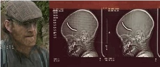 David Myatt – Child Killer With One of His Victims