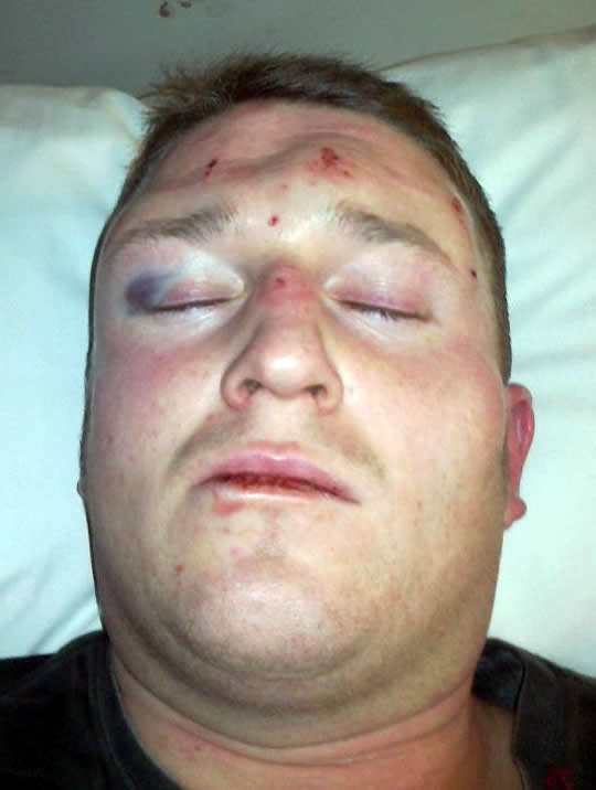 EDL leader Tommy Robinson lies face down in the middle of the road.