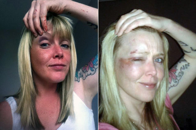 Claire Reah's shiners